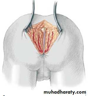 Pediatric surgery