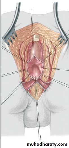 Pediatric surgery