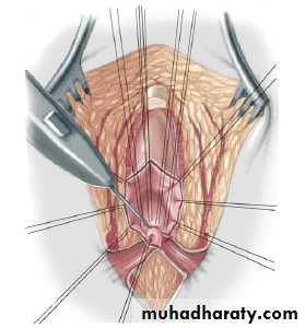 Pediatric surgery
