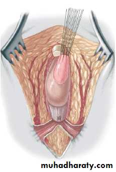 Pediatric surgery