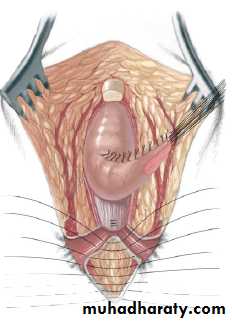 Pediatric surgery