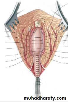 Pediatric surgery