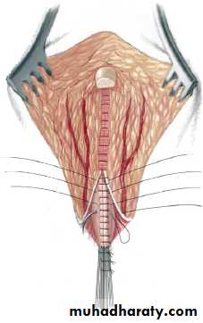 Pediatric surgery