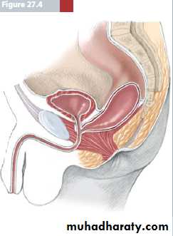 Pediatric surgery