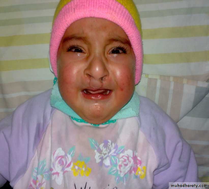 Pediatric surgery