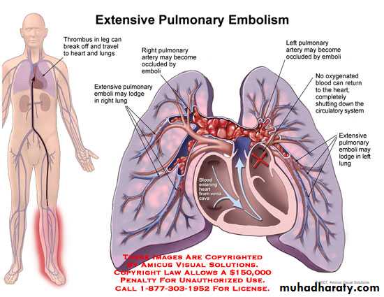 venous disorders