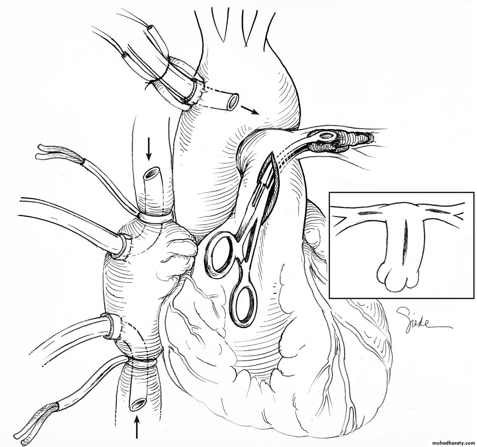 venous disorders