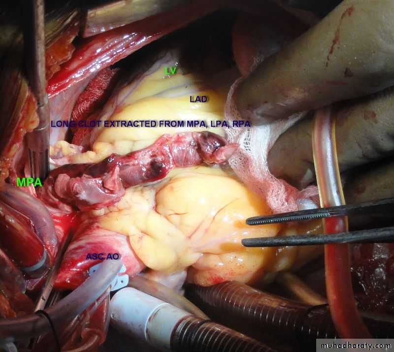 venous disorders