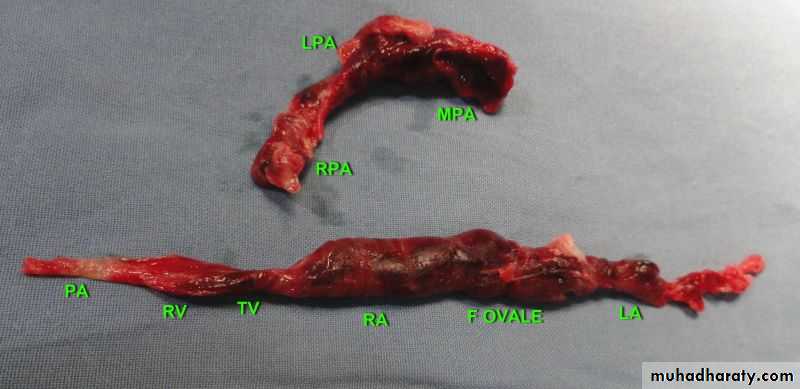 venous disorders