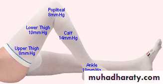 venous disorders