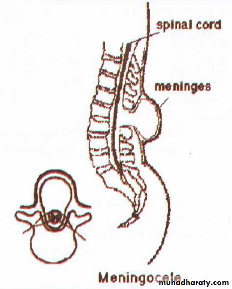Developmental Abnormalities of the Nervous System