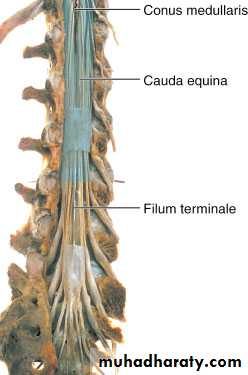 Spine disorders including Disc herniation