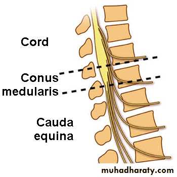 Spine disorders including Disc herniation