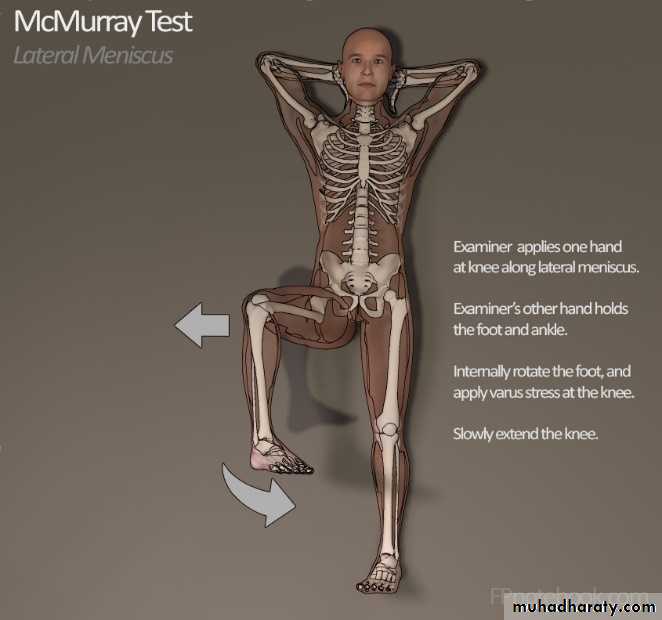 knee disorder