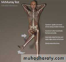 knee disorder