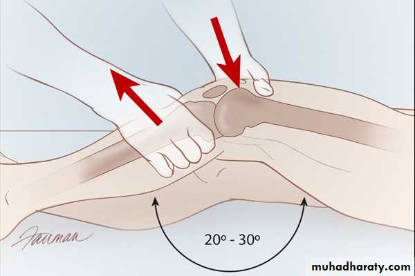 knee disorder