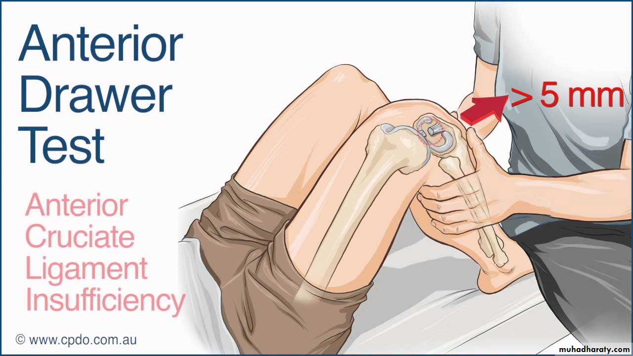 knee disorder