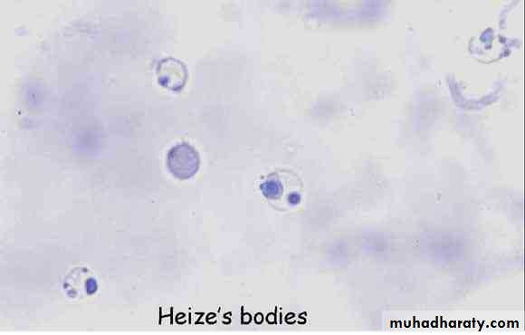 Haematology Anemia