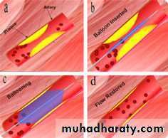 arterial disaeses