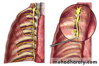 arterial disaeses
