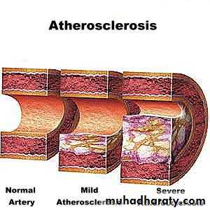 arterial disaeses
