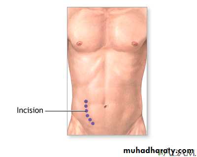 Transplantation