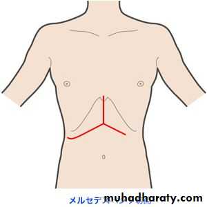 Transplantation