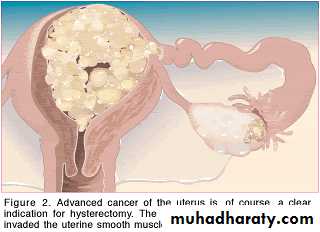 Abnormal uterine bleeding