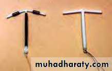 Abnormal uterine bleeding