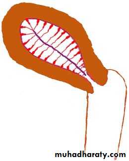 Abnormal uterine bleeding