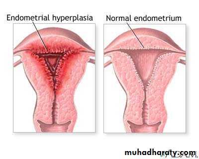 Abnormal uterine bleeding