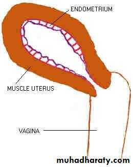 Abnormal uterine bleeding