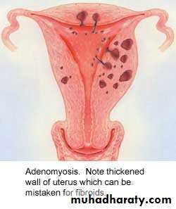 Abnormal uterine bleeding