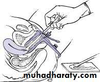 Premalignat disease