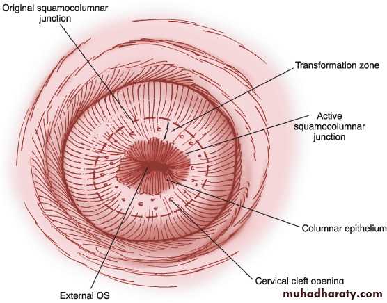 Premalignat disease