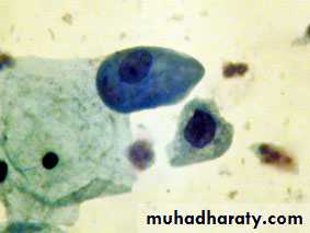 Premalignat disease