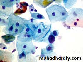 Premalignat disease