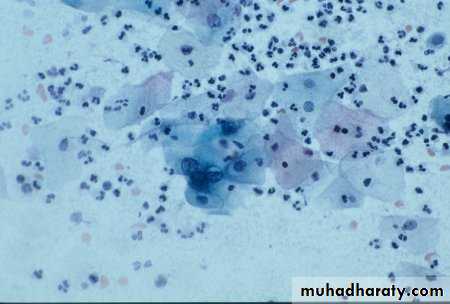 Premalignat disease