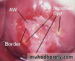 Premalignat disease