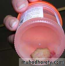 Premalignat disease