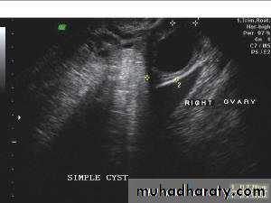 Ultrasonography in Gynaecology