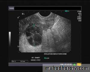 Ultrasonography in Gynaecology