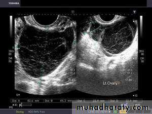Ultrasonography in Gynaecology