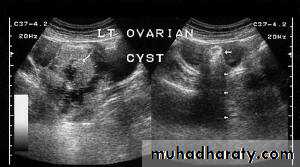 Ultrasonography in Gynaecology