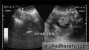 Ultrasonography in Gynaecology