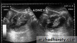 Ultrasonography in Gynaecology