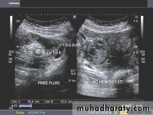 Ultrasonography in Gynaecology