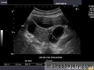 Ultrasonography in Gynaecology