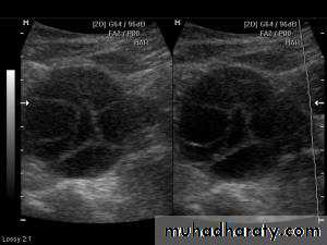 Ultrasonography in Gynaecology