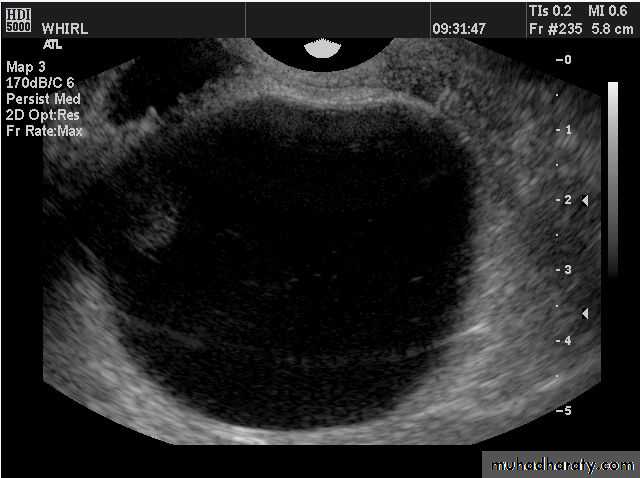 Ultrasonography in Gynaecology